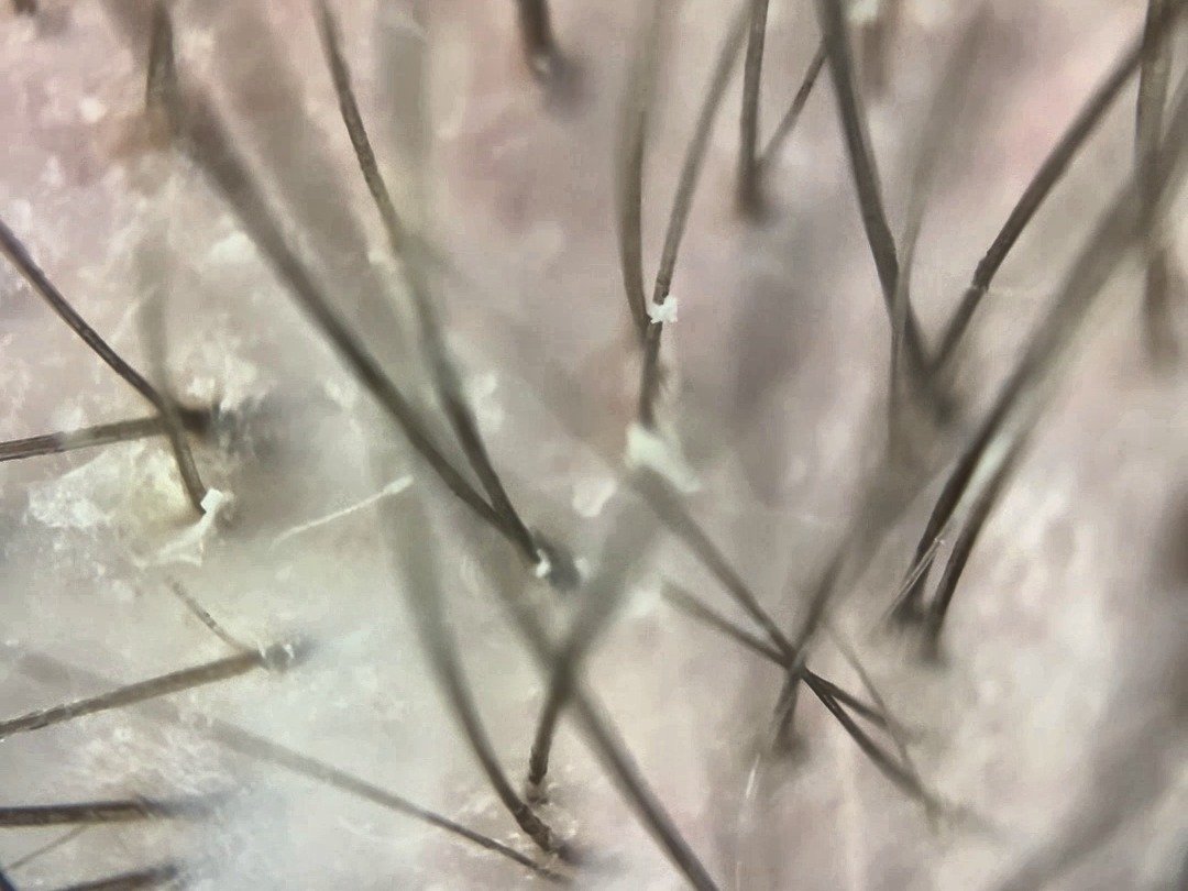 Mild surface dryness